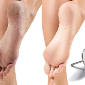 smart_pedicure_charm Täiendkoolitus Smart lihvkettaga pediküür + stardikomplekt